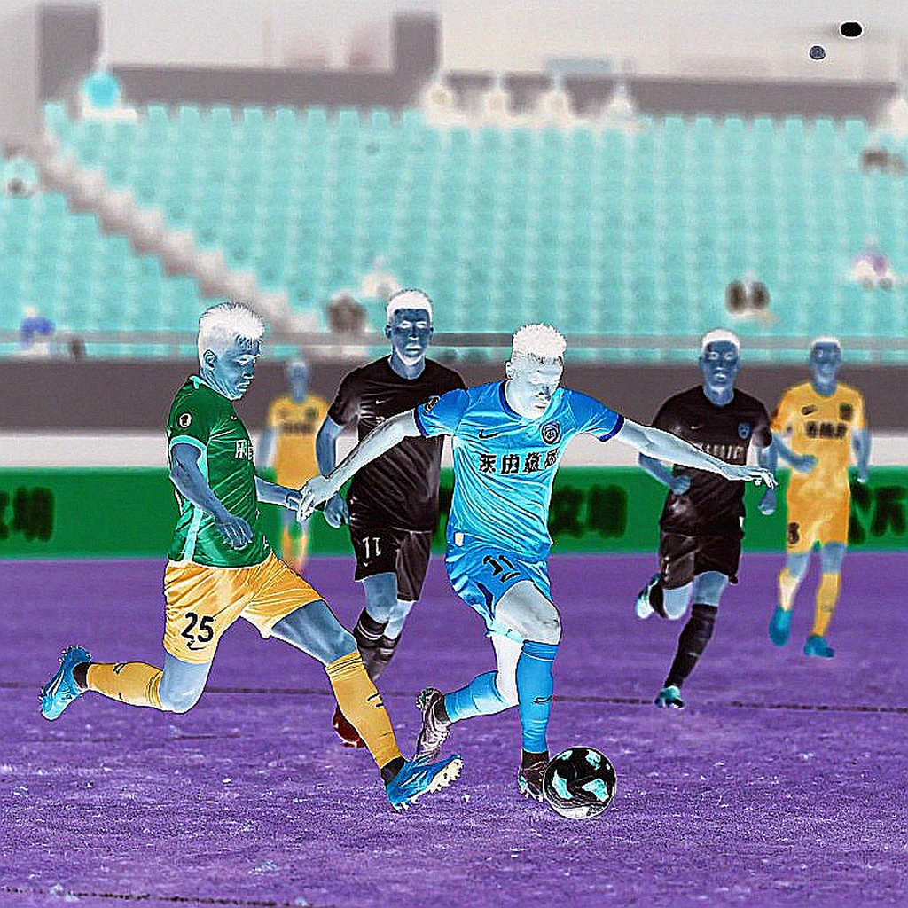 The Physical Misalignment of Vietnamese Football: Why V.League Pressing Vanishes on the Continental Stage The Physical Misalignment of Vietnamese Football: Why V.League Pressing Vanishes on the Continental Stage